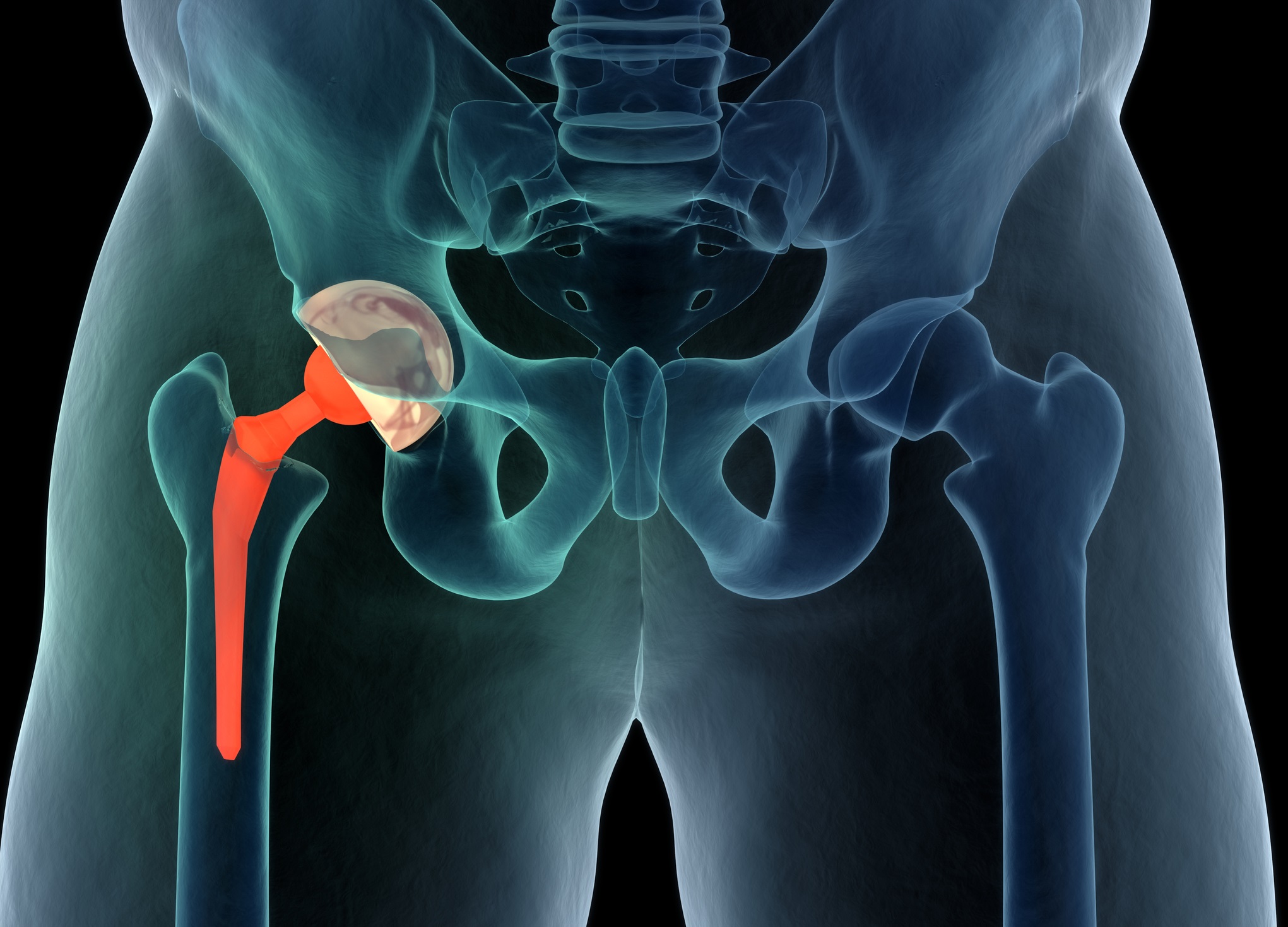 Best Joint Replacement Surgeon