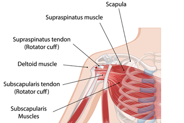 Arthroscopic Rotator Cuff Repair